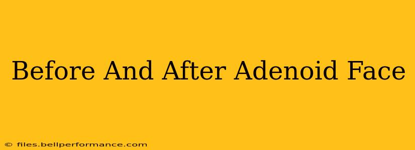 Before And After Adenoid Face